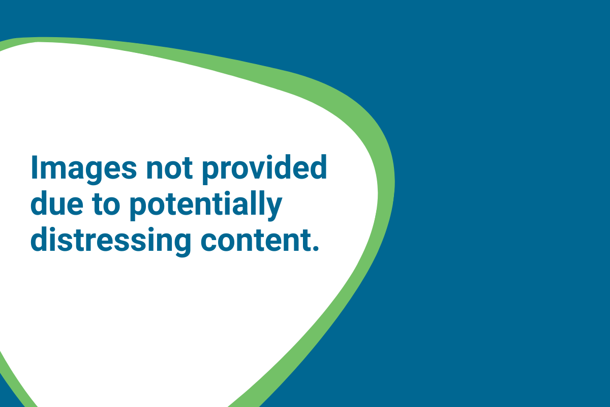 Images not provided due to potentially distressing content